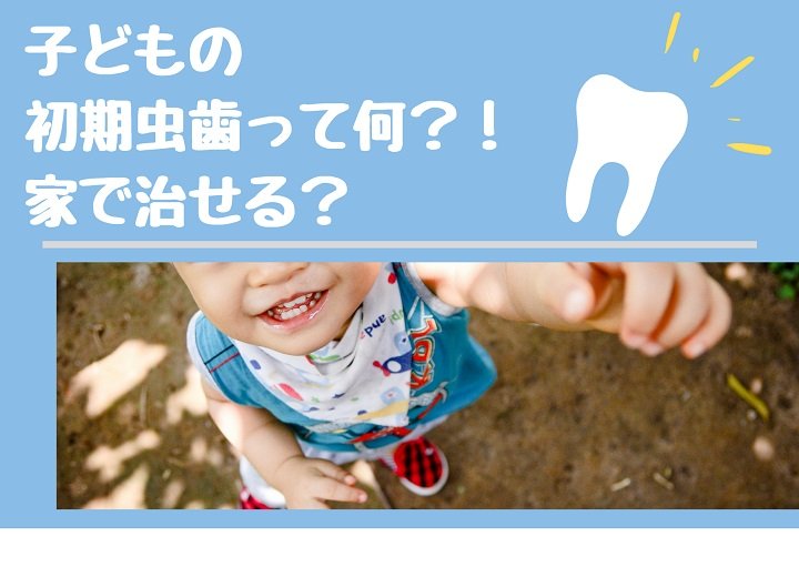 子どもの初期虫歯って何⁈家で治せるの？