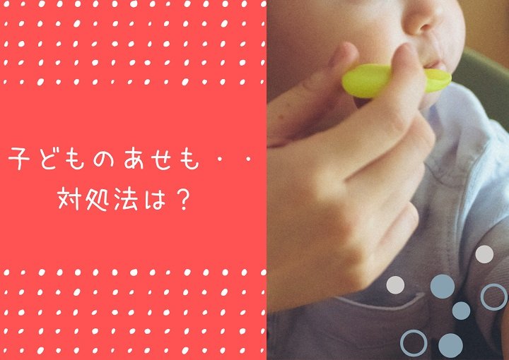 子どものあせも・・なぜ出来やすいの？対処法はある？